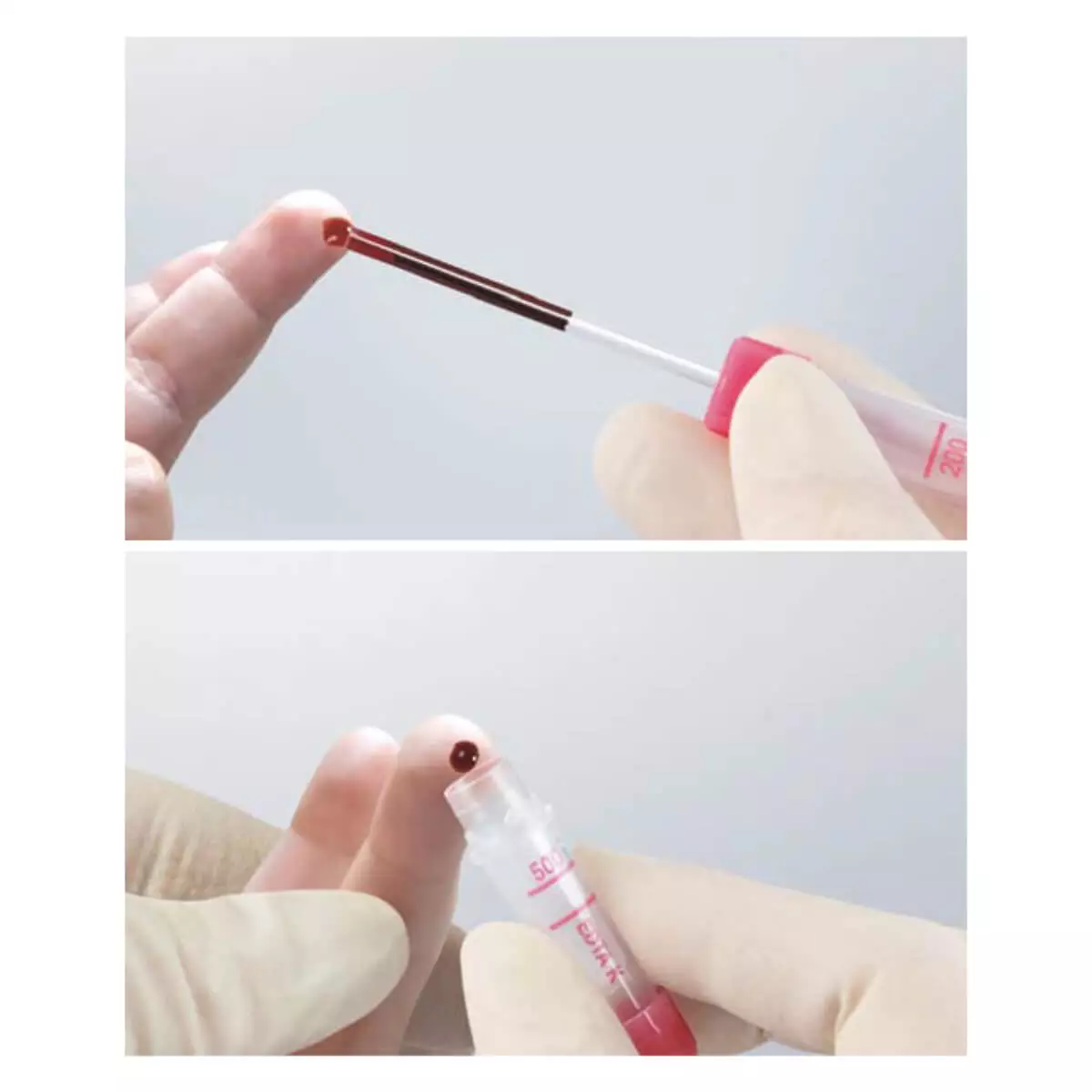  Microvette 200 capillary blood collection system