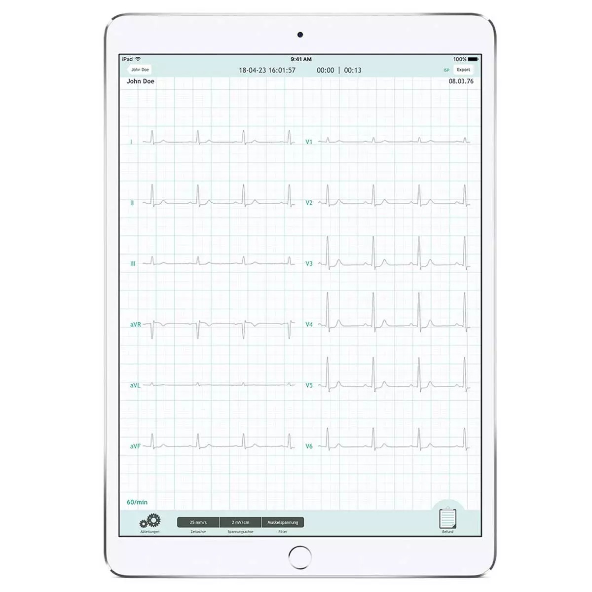  CardioSecur Pro ECG