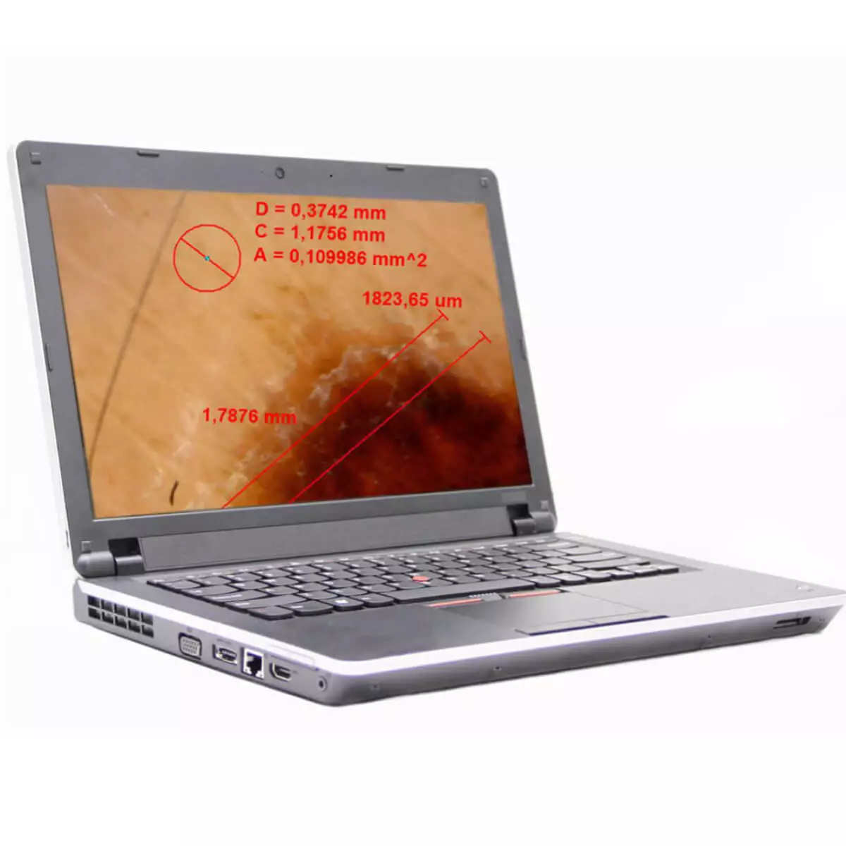  DermaScope Polarizer wireless video dermatoscope