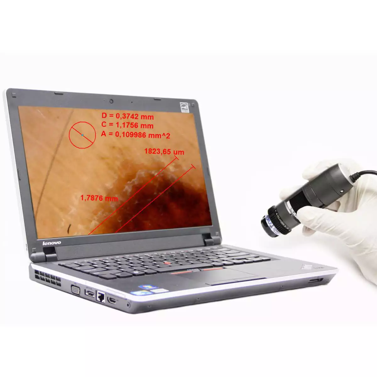  DermaScope Polarizer HR 200x video dermatoscope