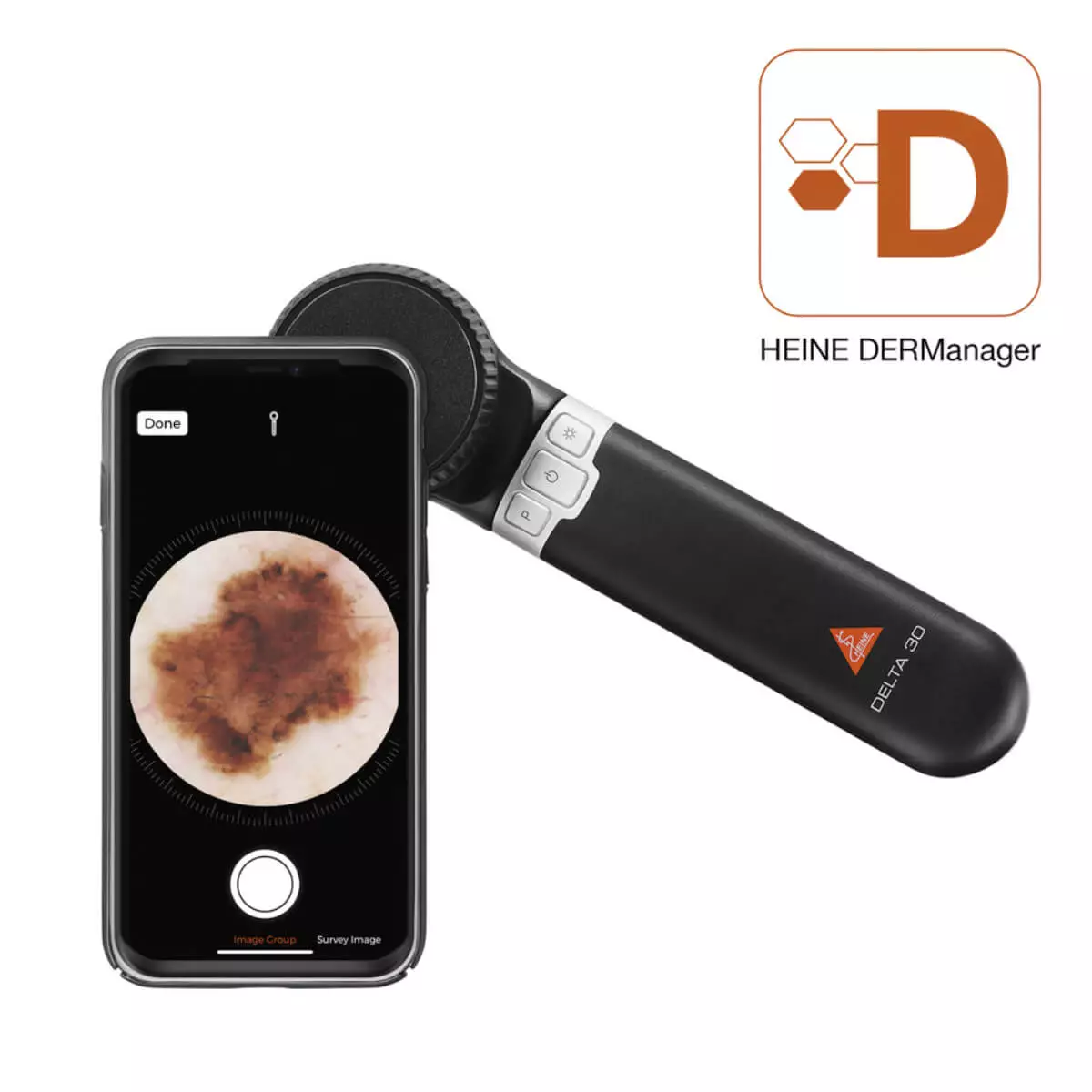  HEINE DELTA 30 Dermatoscope