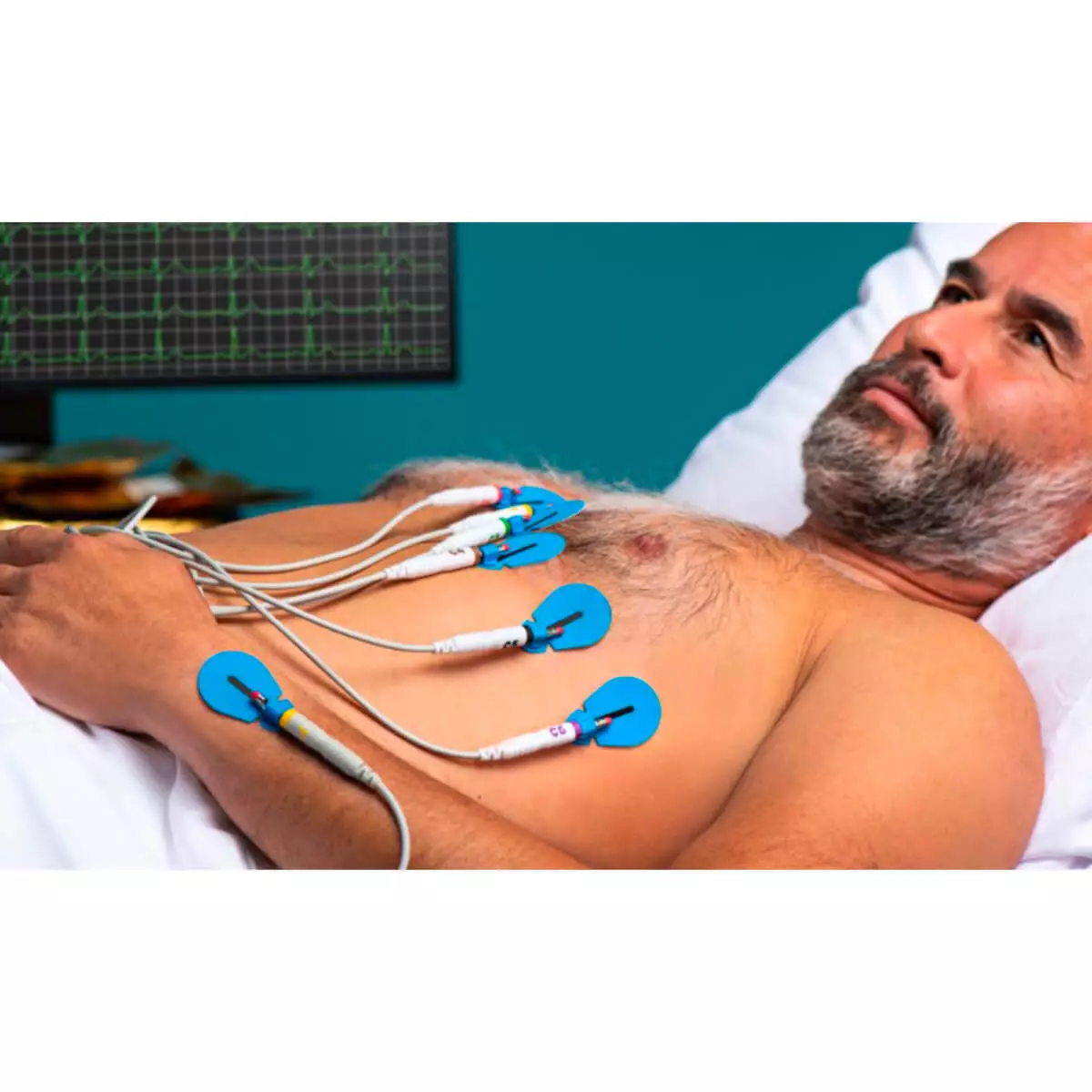  BlueSensor SU-00-A/60 disposable ECG electrodes