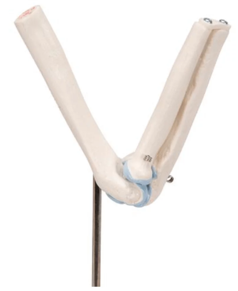  Mini model elbow joint