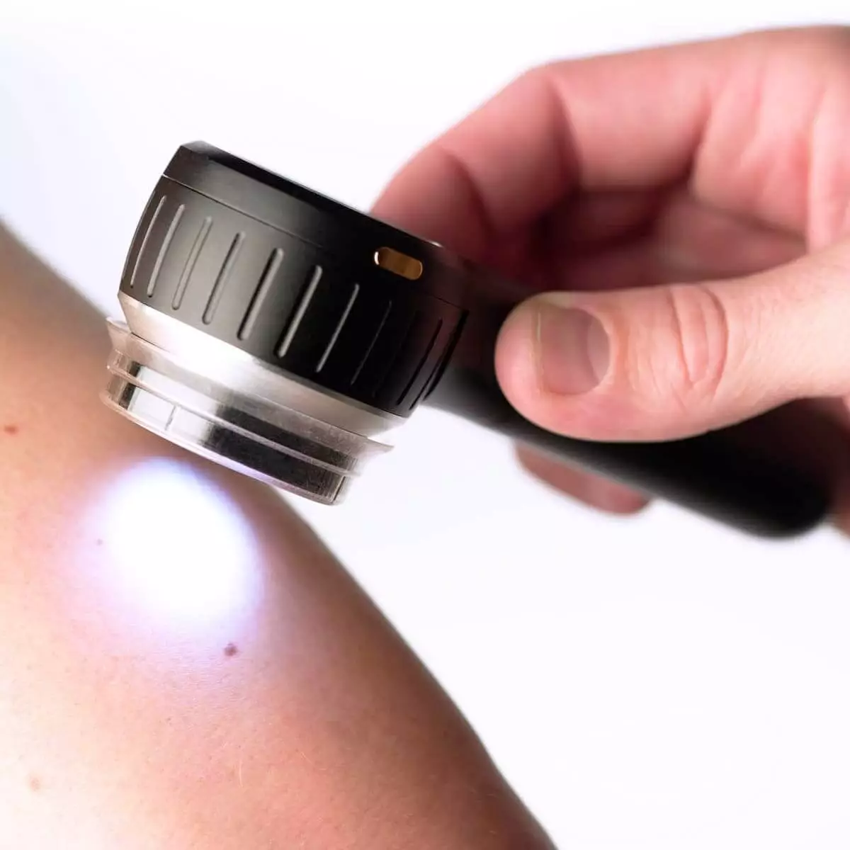  DermLite DL4 Dermatoscope
