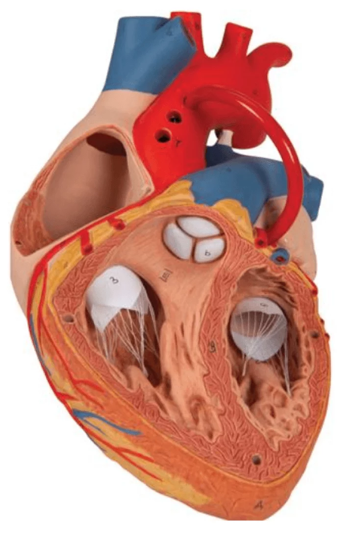  Model heart with bypass