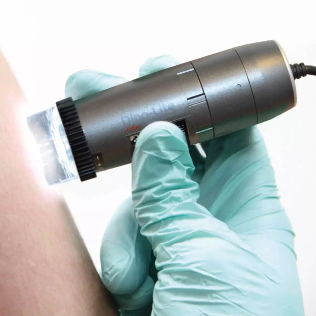  DermaScope Polarizer HR 200x video dermatoscope