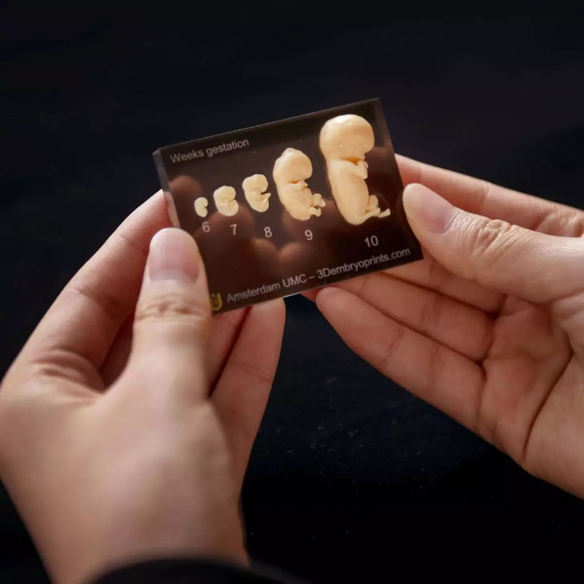 Embryo models – 6th to 10th week of pregnancy Embryo models – 6th to 10th week of pregnancy