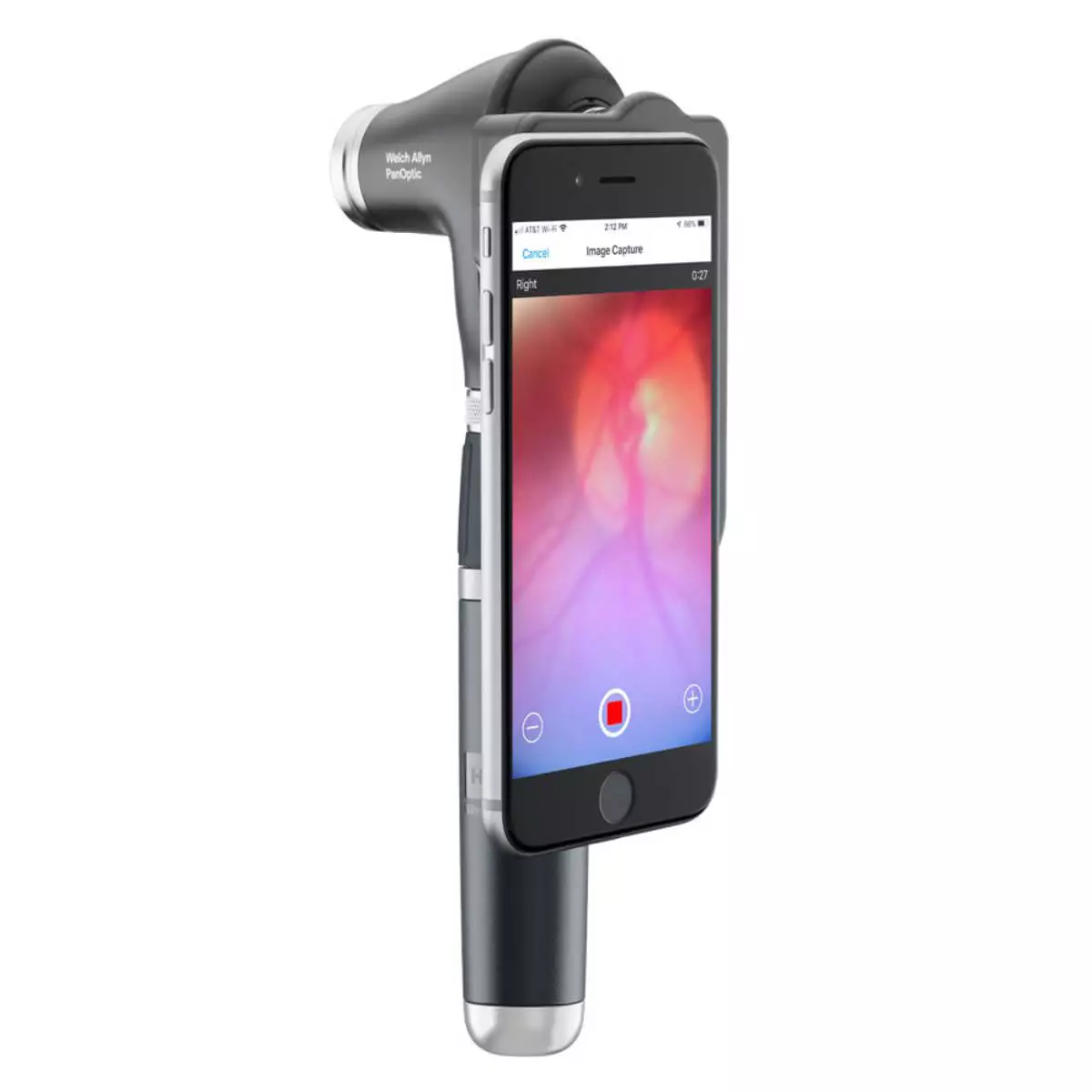  PanOptic Plus ophthalmoscope head with iExaminer