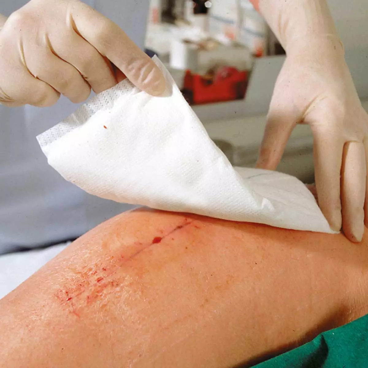 Zetuvit absorbent compresses non-sterile