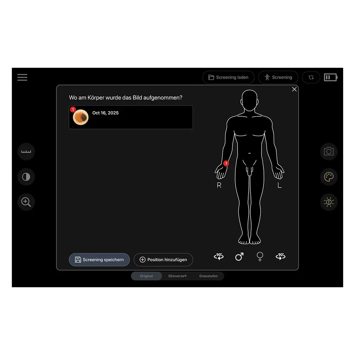  Digital dermatoscope “Scaut®”