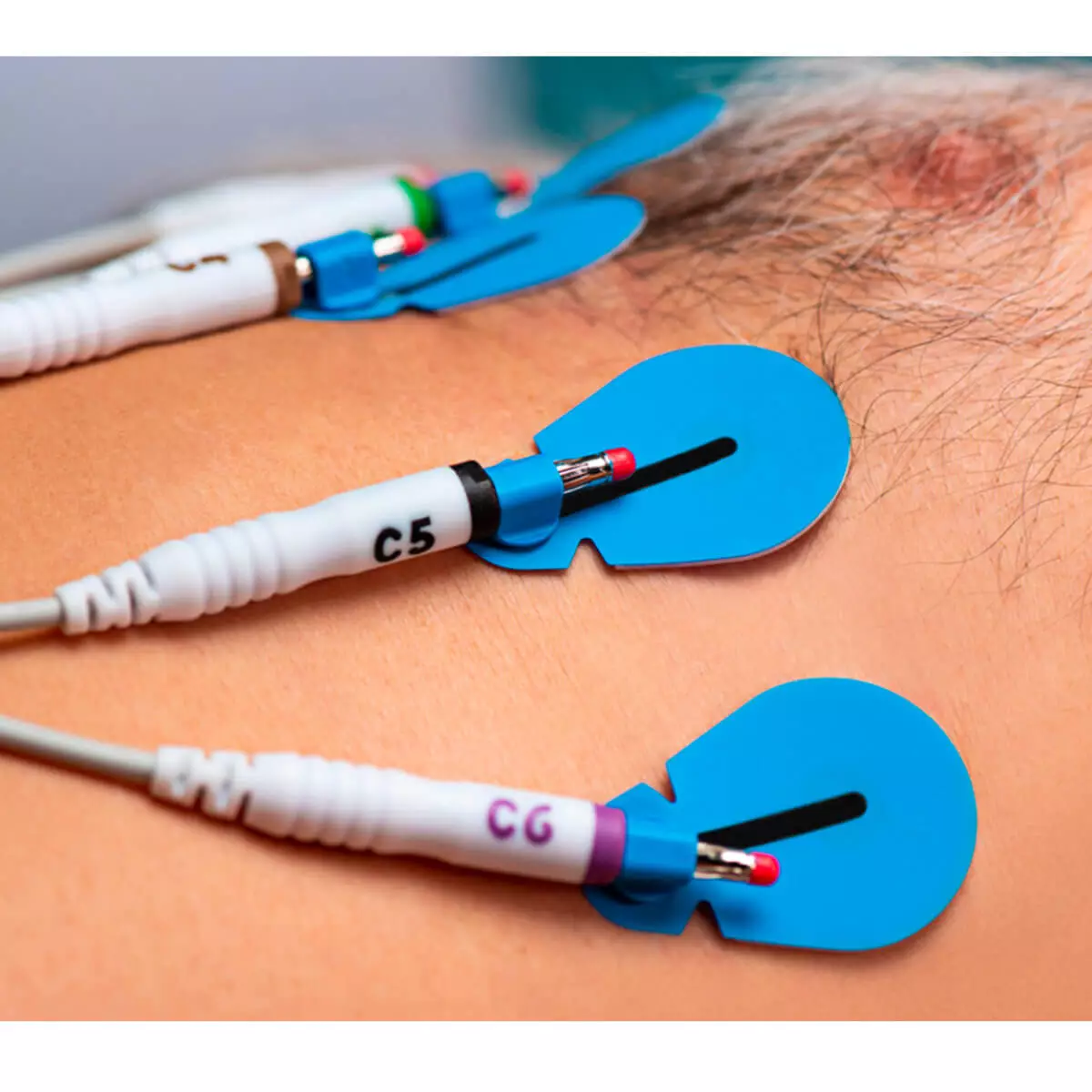  BlueSensor SU-00-A/60 disposable ECG electrodes