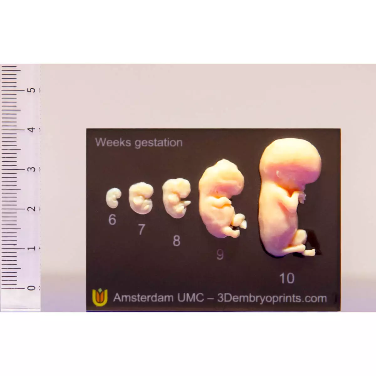 Embryo models – 6th to 10th week of pregnancy Embryo models – 6th to 10th week of pregnancy