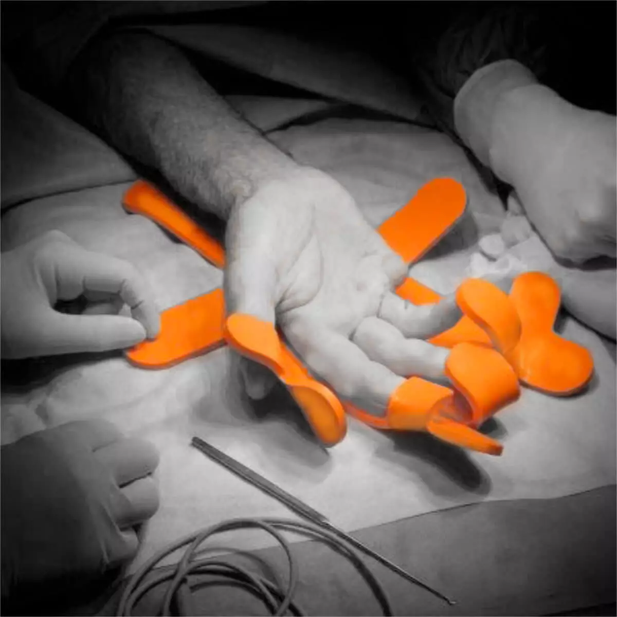  Mano Flexibilo Stabiliser for Surgeries