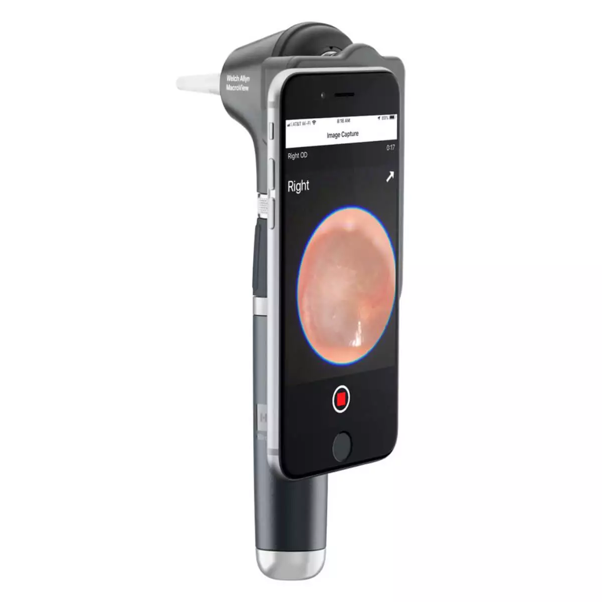  MacroView Plus otoscope head with iExaminer