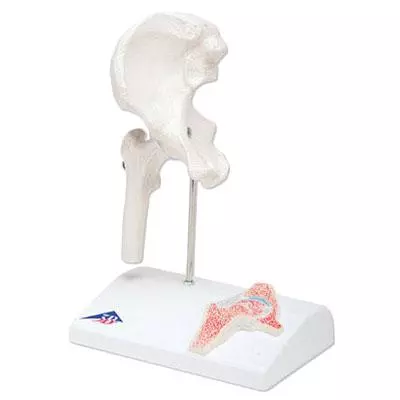  Mini model hip joint
