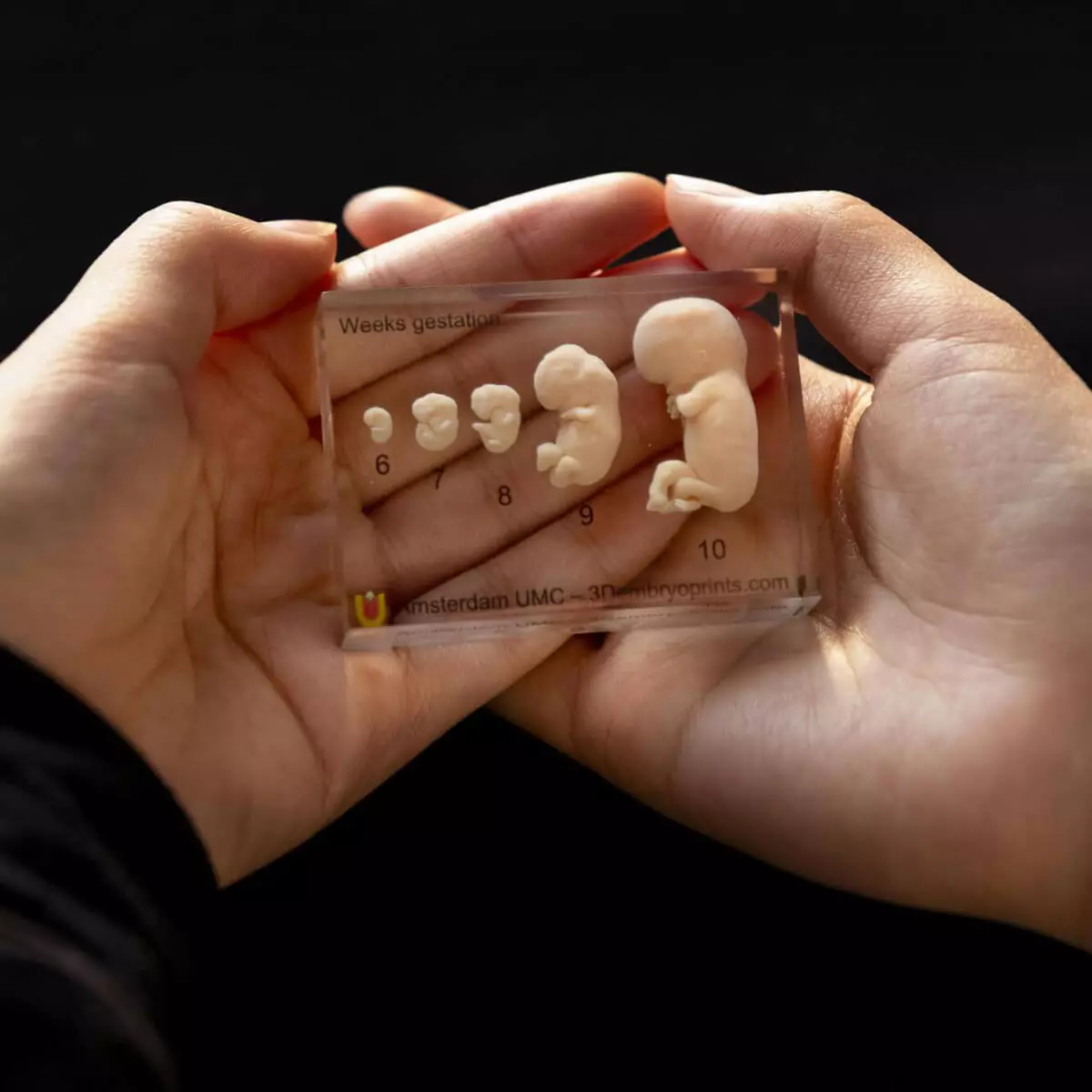 Embryo models – 6th to 10th week of pregnancy Embryo models – 6th to 10th week of pregnancy