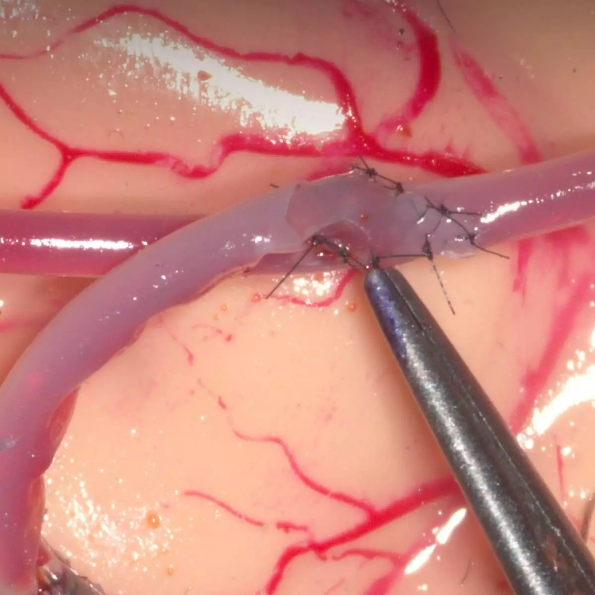  Mycro training system for microvascular anastomoses & micro seams