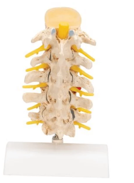  Herniated Disc