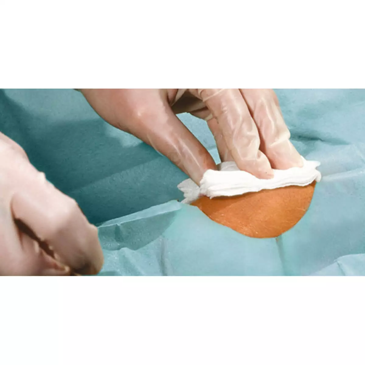  Foliodrape Protect self-adhesive fenestrated drapes