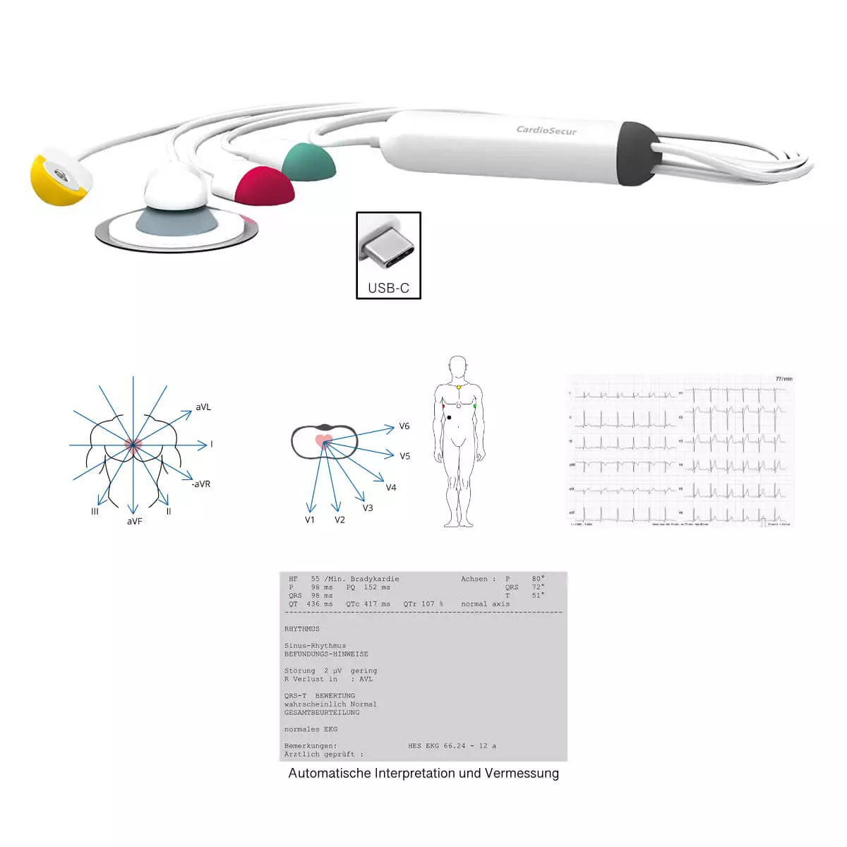 CardioSecur Pro ECG CardioSecur Pro ECG