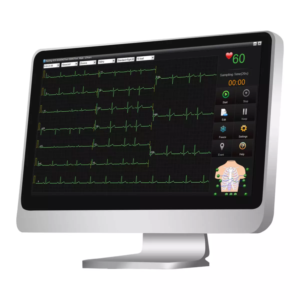  SE-1515 ECG data management software