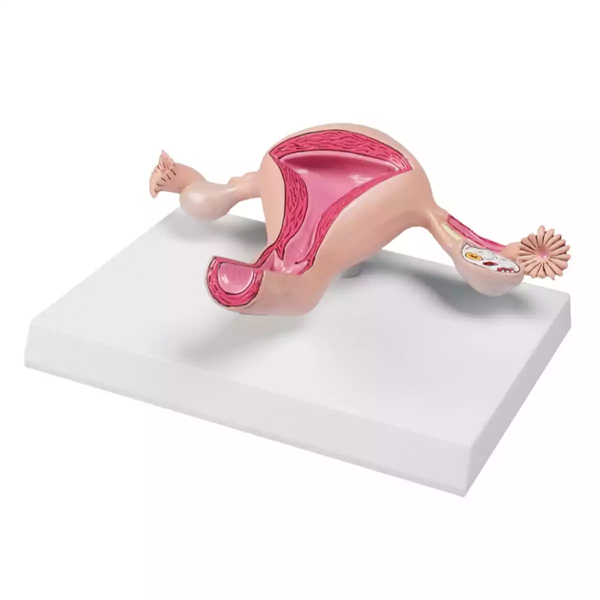  Uterus model