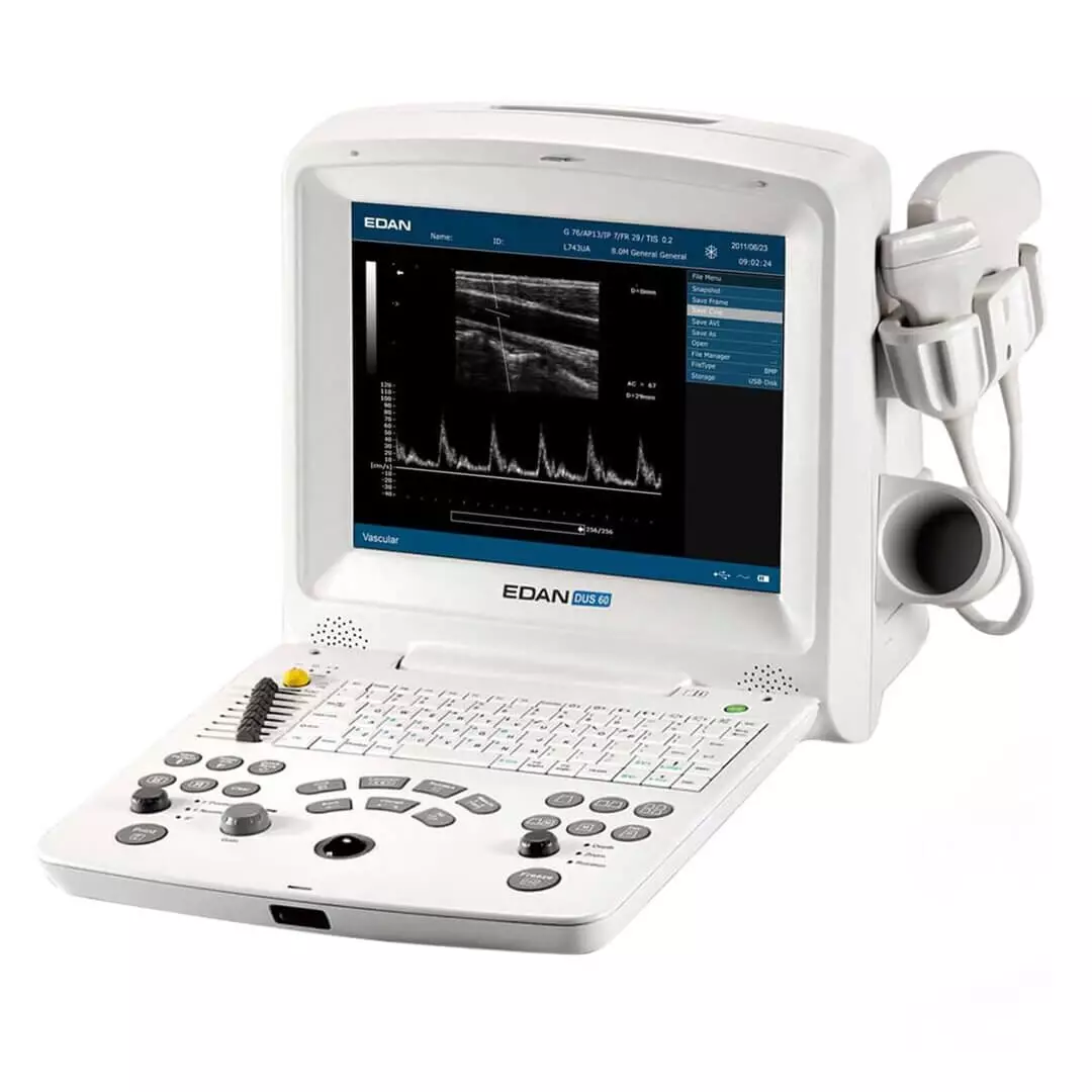  DUS 60 ultrasound scanner