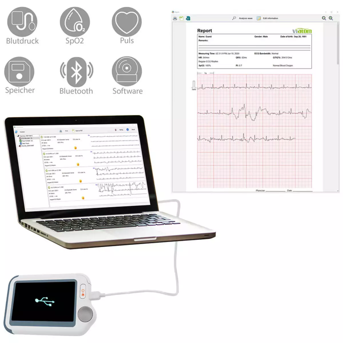  Checkme Lite by Viatom ECG Monitor