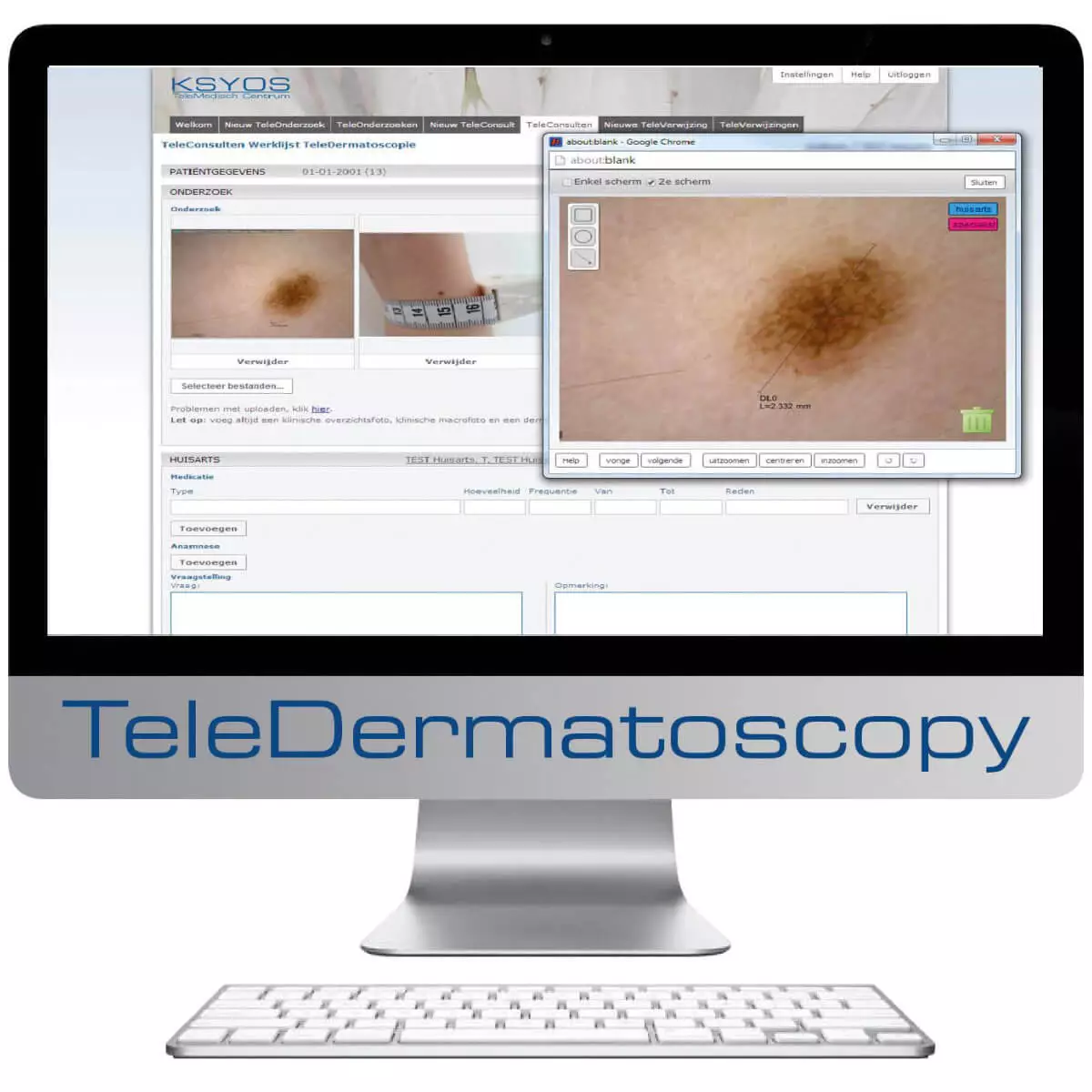  DermaScope Polarizer wireless video dermatoscope