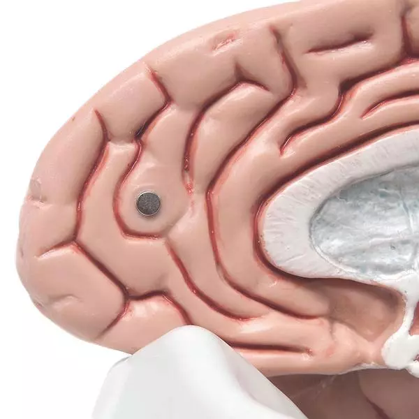  The Classic Brain