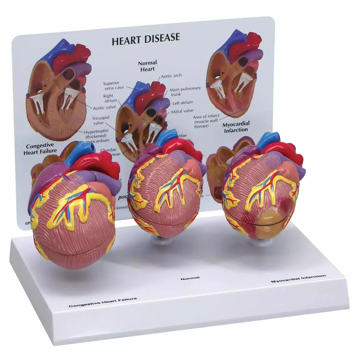  3 Mini Heart Model Set