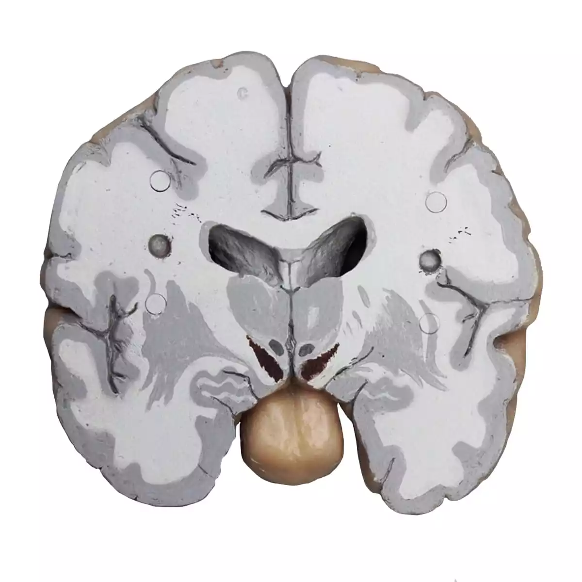  Human brain in frontal sections