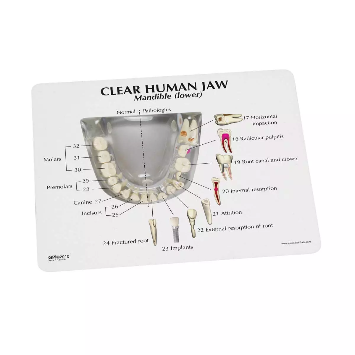  Transparent human jaw