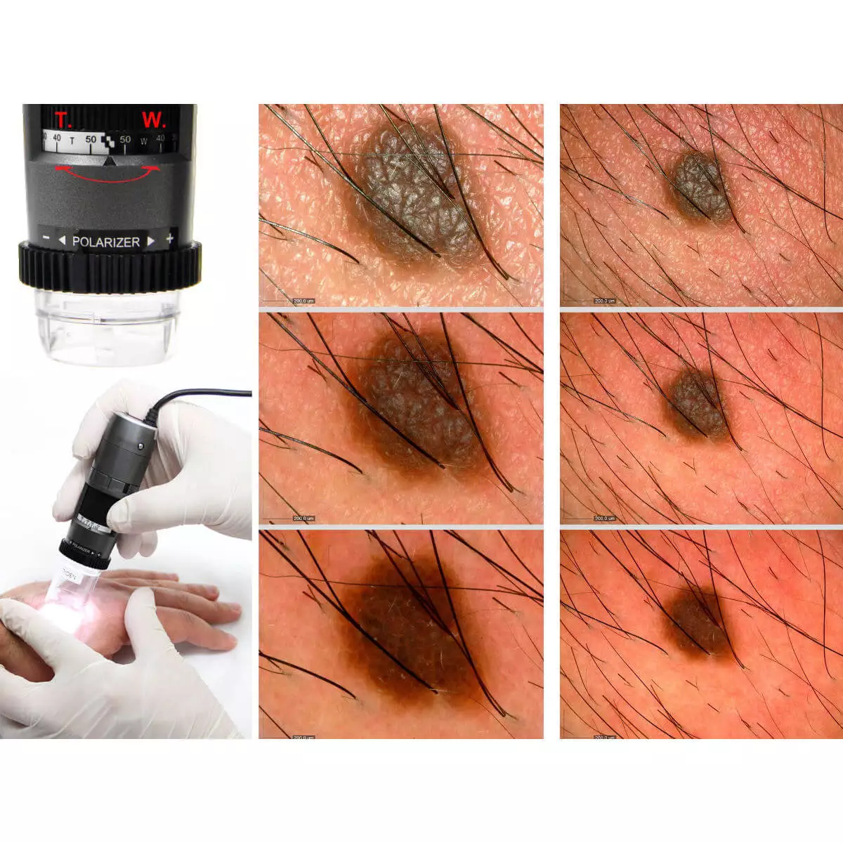  DermaScope Polarizer HR 200x video dermatoscope