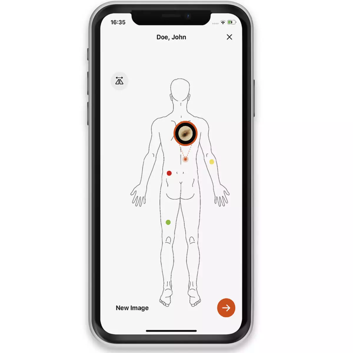  HEINE Adapting Smartphone Case NC2