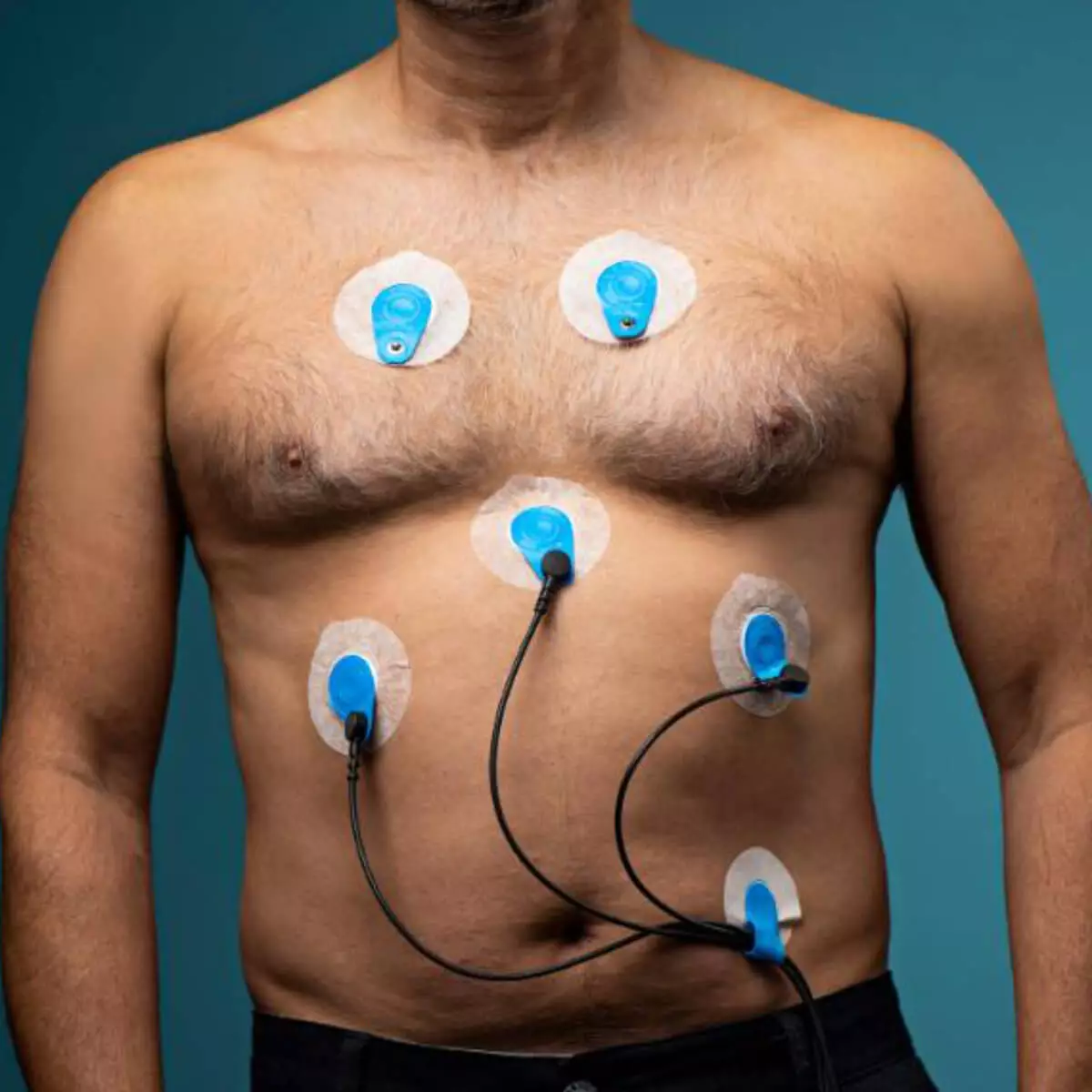  BlueSensor VL single-use electrodes